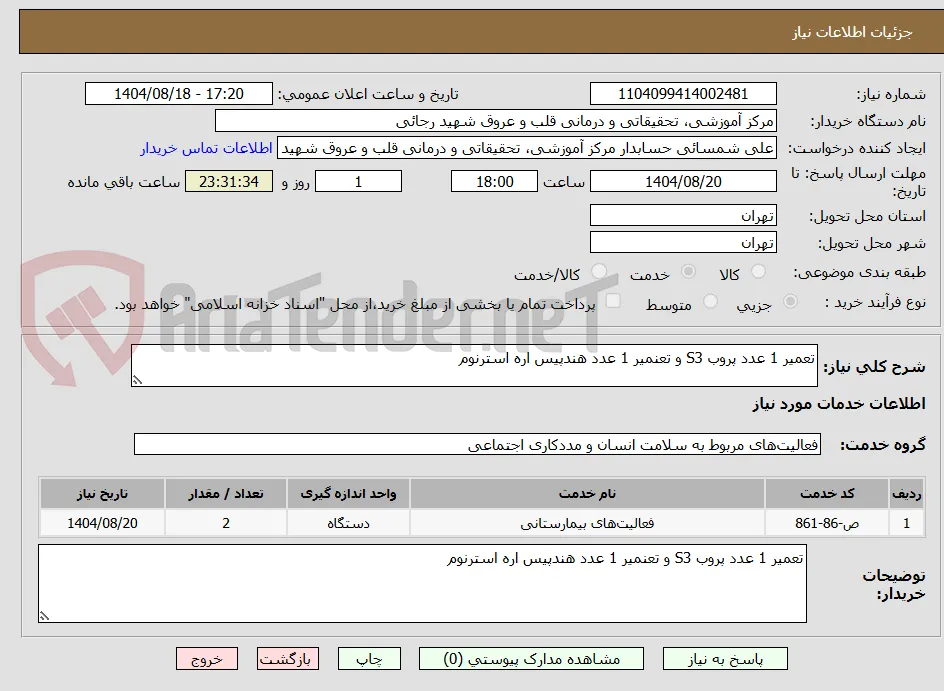تعمیر 1 عدد پروب S3 و تعنمیر 1 عدد هندپیس اره استرنوم
