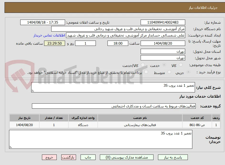 تعمیر 1 عدد پروب 3S