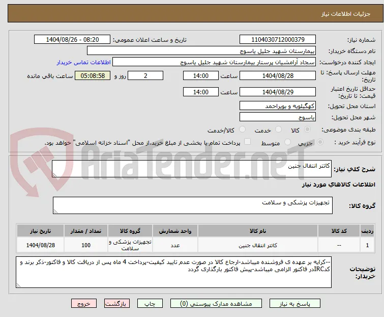 کاتتر انتقال جنین