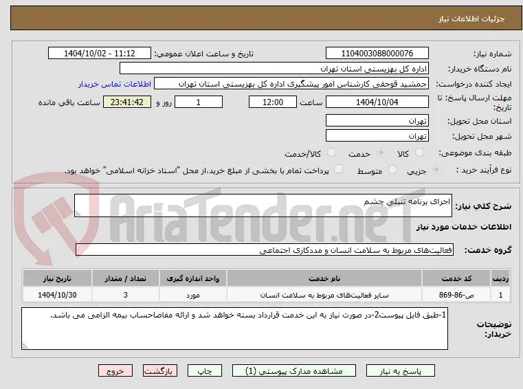اجرای برنامه تنبلی چشم 